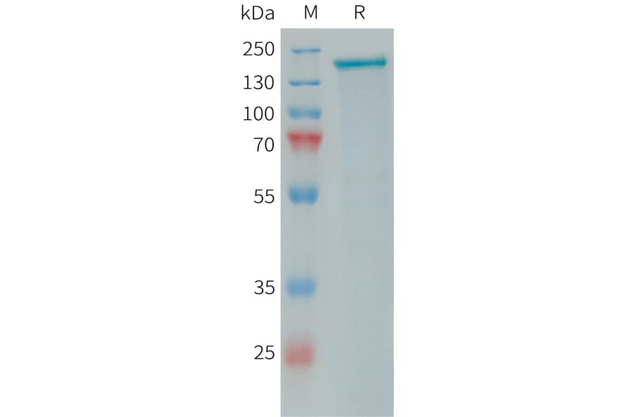 SDS-PAGE - Recombinant Human PLA2R Protein (10×His Tag) (A317646) - Antibodies.com