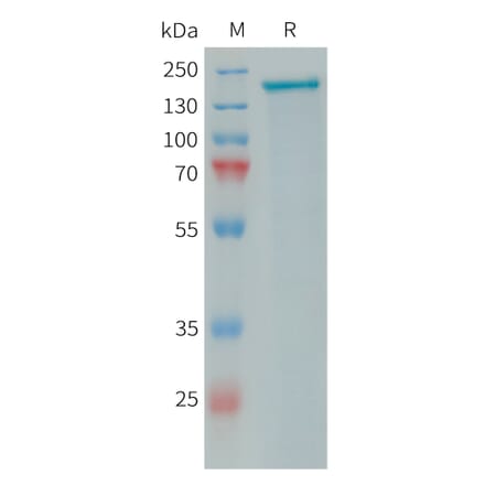 SDS-PAGE - Recombinant Human PLA2R Protein (10×His Tag) (A317646) - Antibodies.com