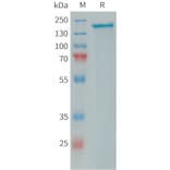 SDS-PAGE - Recombinant Human PLA2R Protein (10×His Tag) (A317646) - Antibodies.com