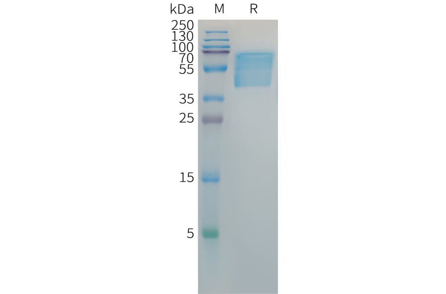 SDS-PAGE - Recombinant Hepatitis B Virus Hepatitis B Surface Antigen Protein (Fc Tag) (A317647) - Antibodies.com