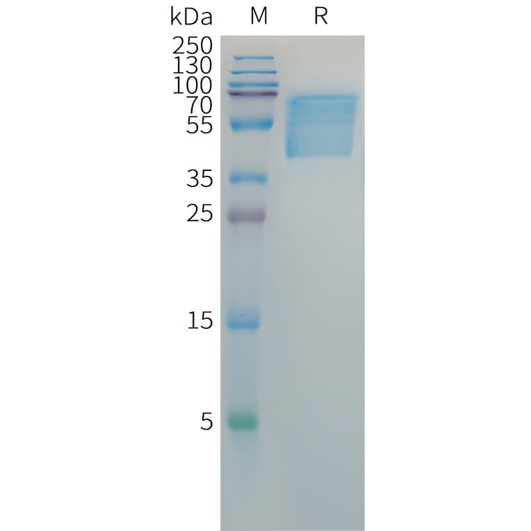 SDS-PAGE - Recombinant Hepatitis B Virus Hepatitis B Surface Antigen Protein (Fc Tag) (A317647) - Antibodies.com