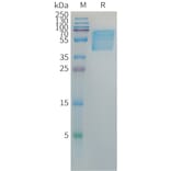 SDS-PAGE - Recombinant Hepatitis B Virus Hepatitis B Surface Antigen Protein (Fc Tag) (A317647) - Antibodies.com