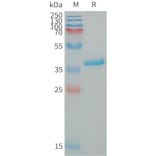 SDS-PAGE - Recombinant Human IGF1 Protein (Fc Tag) (A317648) - Antibodies.com