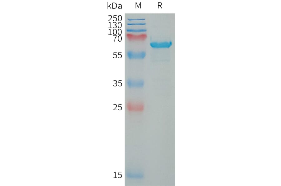 SDS-PAGE - Recombinant Human WFDC1/PS20 Protein (Fc Tag) (A317649) - Antibodies.com