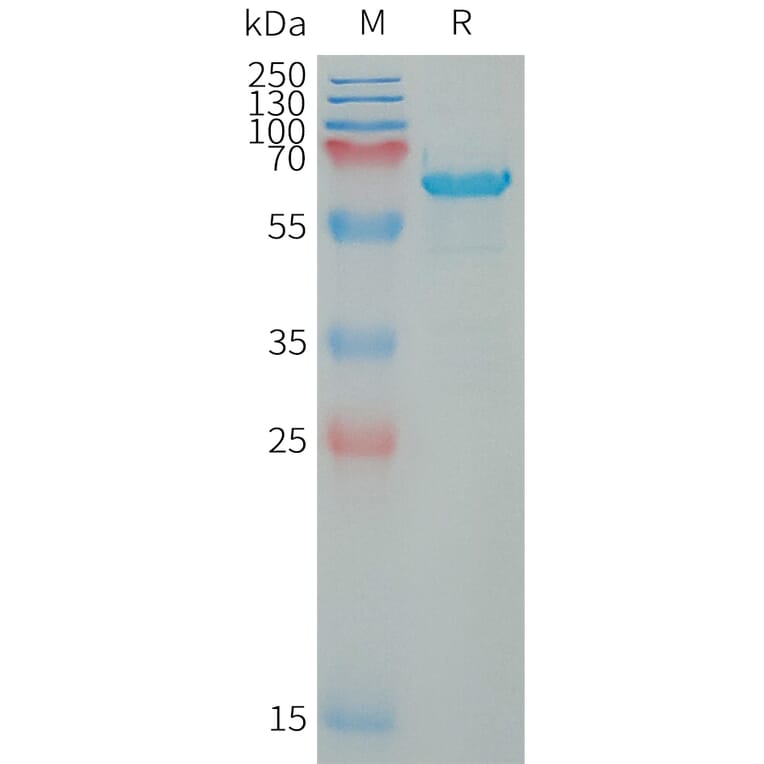 SDS-PAGE - Recombinant Human WFDC1/PS20 Protein (Fc Tag) (A317649) - Antibodies.com