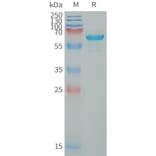 SDS-PAGE - Recombinant Human WFDC1/PS20 Protein (Fc Tag) (A317649) - Antibodies.com