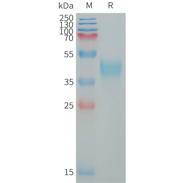 SDS-PAGE - Recombinant Human MXRA8/Asp3 Protein (6×His Tag) (A317650) - Antibodies.com