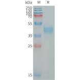 SDS-PAGE - Recombinant Human MXRA8/Asp3 Protein (6×His Tag) (A317650) - Antibodies.com