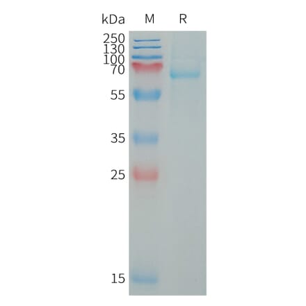 SDS-PAGE - Recombinant Human LILRB5 Protein (6×His Tag) (A317651) - Antibodies.com