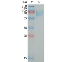 SDS-PAGE - Recombinant Human LILRA2 Protein (6×His Tag) (A317652) - Antibodies.com