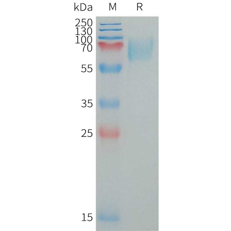 SDS-PAGE - Recombinant Human LILRA2 Protein (6×His Tag) (A317652) - Antibodies.com
