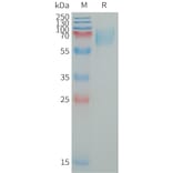 SDS-PAGE - Recombinant Human LILRA2 Protein (6×His Tag) (A317652) - Antibodies.com