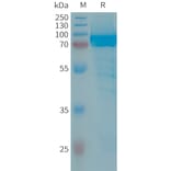 SDS-PAGE - Recombinant Human IL-13 Receptor alpha 2 Protein (Fc Tag) (A317653) - Antibodies.com