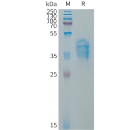 SDS-PAGE - Recombinant Human Von Willebrand Factor Protein (Fc Tag) (A317654) - Antibodies.com