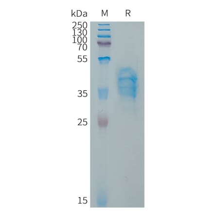 SDS-PAGE - Recombinant Human Von Willebrand Factor Protein (Fc Tag) (A317654) - Antibodies.com