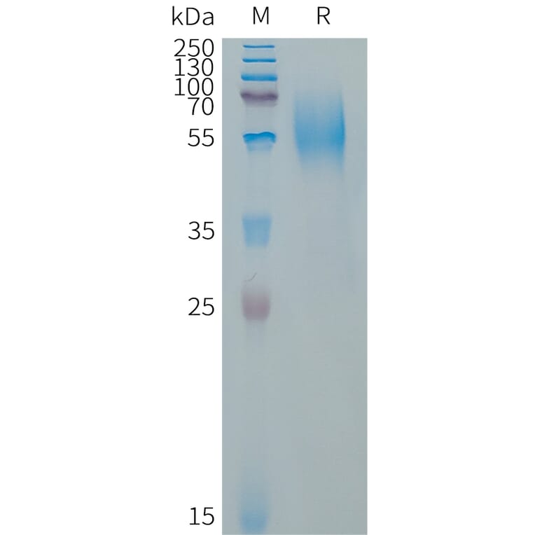 SDS-PAGE - Recombinant Human CD79a Protein (Fc Tag) (A317656) - Antibodies.com