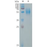 SDS-PAGE - Recombinant Human CD79a Protein (Fc Tag) (A317656) - Antibodies.com