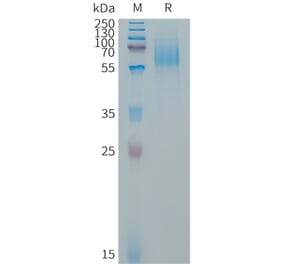 SDS-PAGE - Recombinant Human EGFR Protein (267 aa deletion variant) (6×His Tag) (A317657) - Antibodies.com
