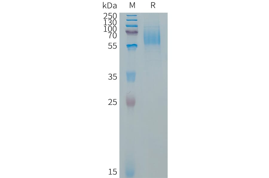 SDS-PAGE - Recombinant Human EGFR Protein (267 aa deletion variant) (6×His Tag) (A317657) - Antibodies.com