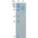 SDS-PAGE - Recombinant Human EGFR Protein (267 aa deletion variant) (6×His Tag) (A317657) - Antibodies.com