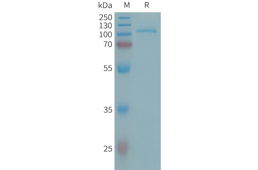 SDS-PAGE - Recombinant Human ENPP2/ATX Protein (6×His Tag) (A317658) - Antibodies.com
