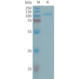 SDS-PAGE - Recombinant Human ENPP2/ATX Protein (6×His Tag) (A317658) - Antibodies.com