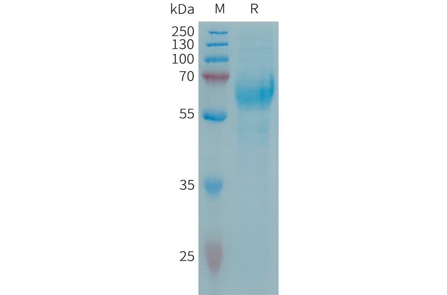 SDS-PAGE - Recombinant Human Neuroglycan C Protein (6×His Tag) (A317659) - Antibodies.com