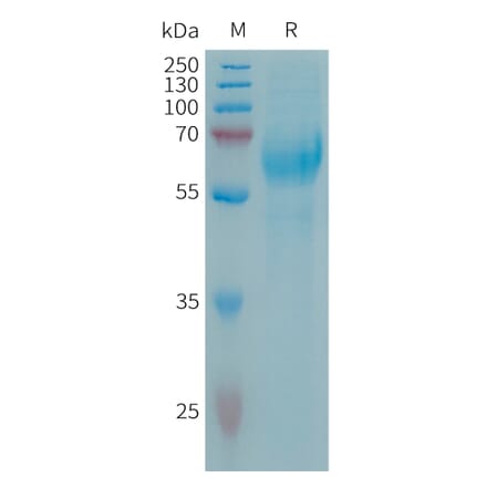 SDS-PAGE - Recombinant Human Neuroglycan C Protein (6×His Tag) (A317659) - Antibodies.com