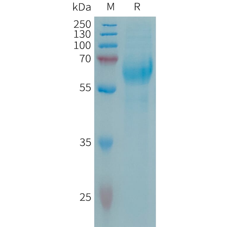 SDS-PAGE - Recombinant Human Neuroglycan C Protein (6×His Tag) (A317659) - Antibodies.com