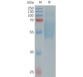 SDS-PAGE - Recombinant Human IL-36R Protein (6×His Tag) (A317660) - Antibodies.com