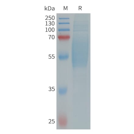 SDS-PAGE - Recombinant Human IL-36R Protein (6×His Tag) (A317660) - Antibodies.com