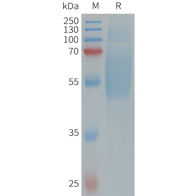 SDS-PAGE - Recombinant Human IL-36R Protein (6×His Tag) (A317660) - Antibodies.com