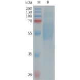 SDS-PAGE - Recombinant Human IL-36R Protein (6×His Tag) (A317660) - Antibodies.com
