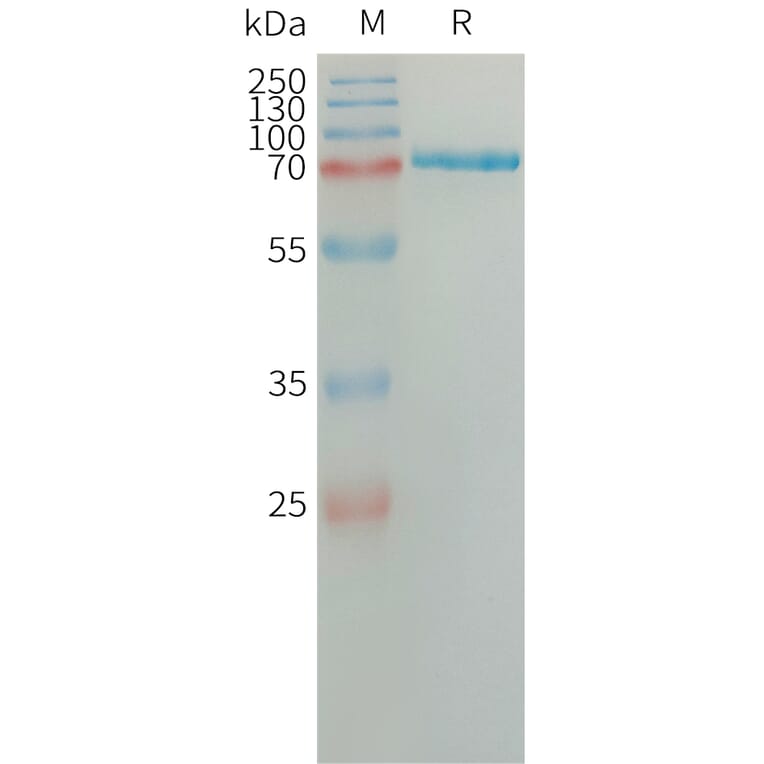 SDS-PAGE - Recombinant Human Semaphorin 7a Protein (6×His Tag) (A317661) - Antibodies.com