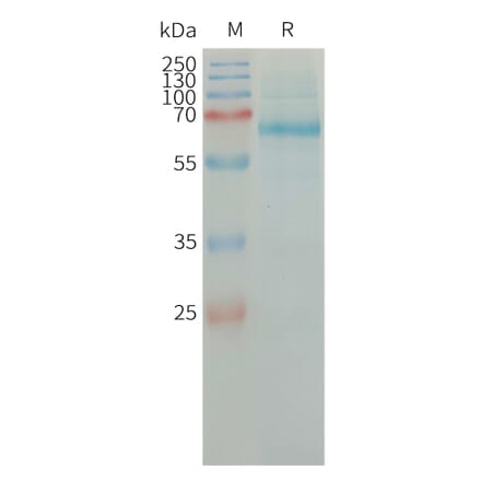 SDS-PAGE - Recombinant Human Tissue Plasminogen Activator Protein (6×His Tag) (A317662) - Antibodies.com