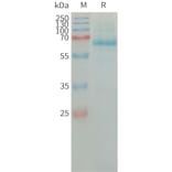 SDS-PAGE - Recombinant Human Tissue Plasminogen Activator Protein (6×His Tag) (A317662) - Antibodies.com