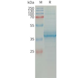 SDS-PAGE - Recombinant Human Eotaxin Protein (Fc Tag) (A317663) - Antibodies.com