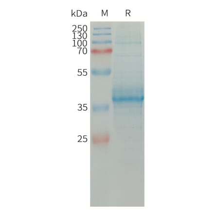 SDS-PAGE - Recombinant Human Eotaxin Protein (Fc Tag) (A317663) - Antibodies.com