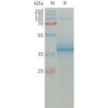 SDS-PAGE - Recombinant Human Eotaxin Protein (Fc Tag) (A317663) - Antibodies.com