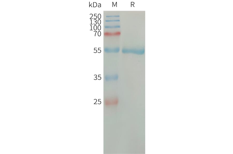 SDS-PAGE - Recombinant Human Factor D/CFD Protein (Fc Tag) (A317664) - Antibodies.com