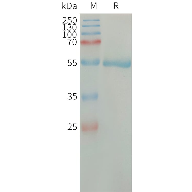 SDS-PAGE - Recombinant Human Factor D/CFD Protein (Fc Tag) (A317664) - Antibodies.com