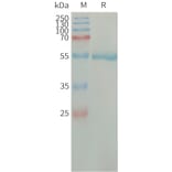 SDS-PAGE - Recombinant Human Factor D/CFD Protein (Fc Tag) (A317664) - Antibodies.com