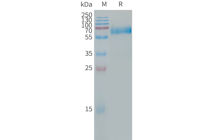 SDS-PAGE - Recombinant Human CLEC5A Protein (Fc Tag) (A317665) - Antibodies.com