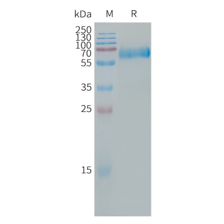 SDS-PAGE - Recombinant Human CLEC5A Protein (Fc Tag) (A317665) - Antibodies.com
