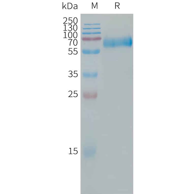 SDS-PAGE - Recombinant Human CLEC5A Protein (Fc Tag) (A317665) - Antibodies.com