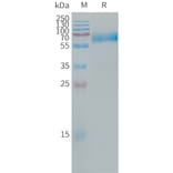 SDS-PAGE - Recombinant Human CLEC5A Protein (Fc Tag) (A317665) - Antibodies.com