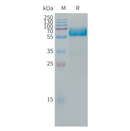 SDS-PAGE - Recombinant Human LOX 1 Protein (Fc Tag) (A317666) - Antibodies.com