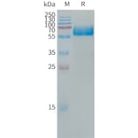 SDS-PAGE - Recombinant Human LOX 1 Protein (Fc Tag) (A317666) - Antibodies.com