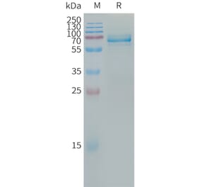 SDS-PAGE - Recombinant Human ILT-3 Protein (Fc Tag) (A317667) - Antibodies.com