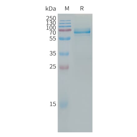 SDS-PAGE - Recombinant Human ILT-3 Protein (Fc Tag) (A317667) - Antibodies.com